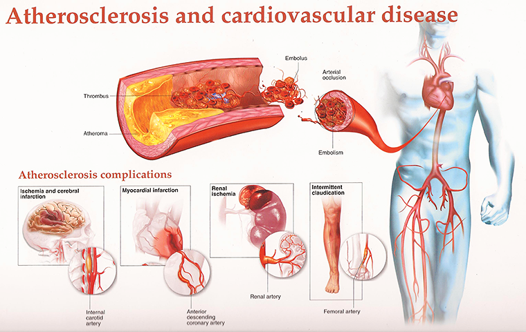 laminine cardiovascular health